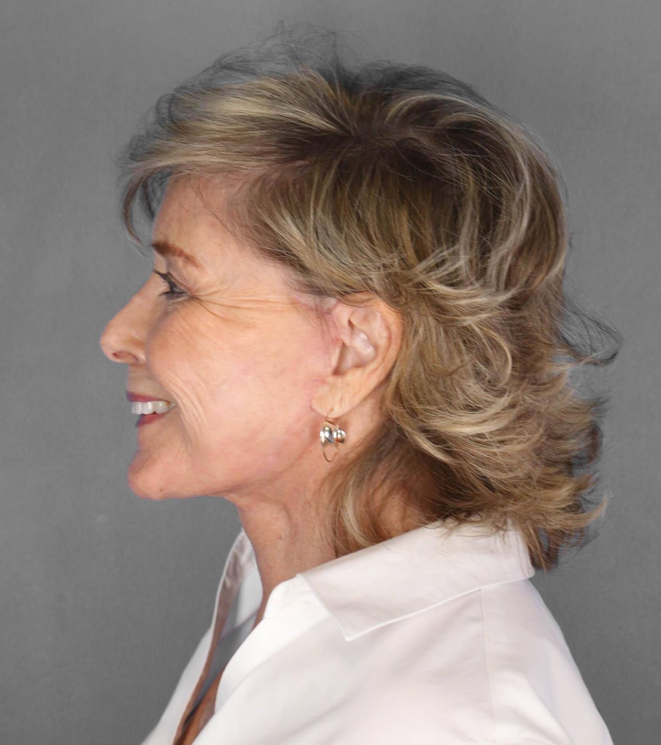 Co2 Laser Before & After