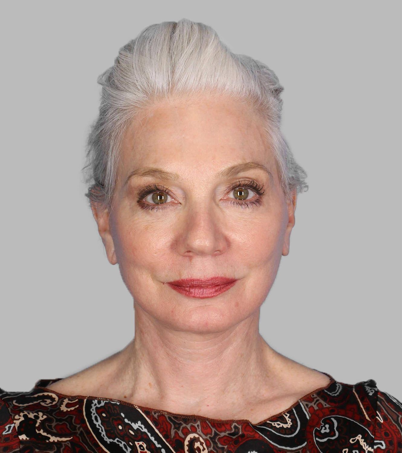 Co2 Laser Before & After